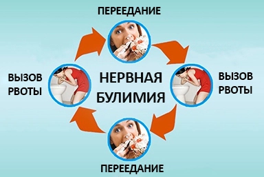 Лечение булимии в Обливской